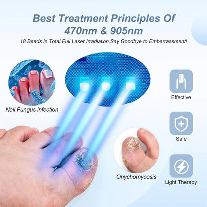 Nail Fungus Laser Device for Multiple Toenail 905nm470nm 7Minutes Painless Removes Ingrown Toenail Calcium Nail Fungus Treatment