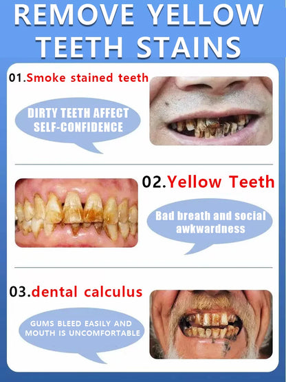2025 New Formula 7-Day Whitening Essence Gel – Effectively removes coffee, tea, and tobacco stains, protects tooth enamel and p