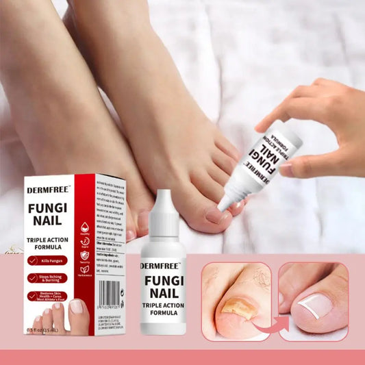 15ml Herbal Toenail Fungus Repair Solution For Strong Repair Mild And Non-irritating And Quick Penetration Into The Cuticles