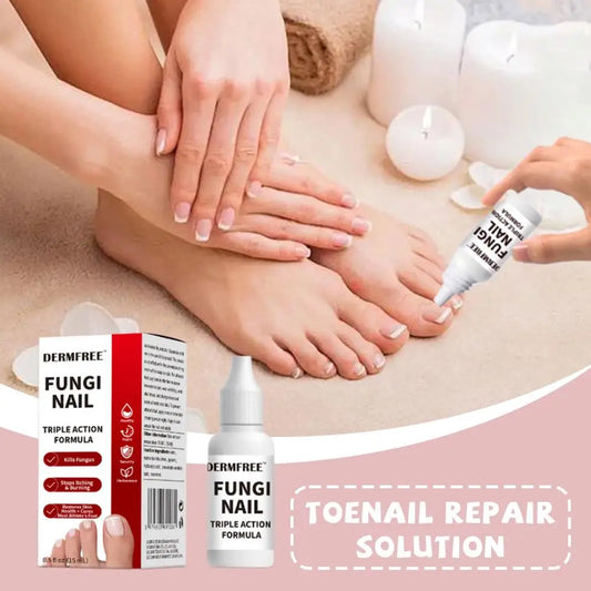15ml Herbal Toenail Fungus Repair Solution For Strong Repair Mild And Non-irritating And Quick Penetration Into The Cuticles