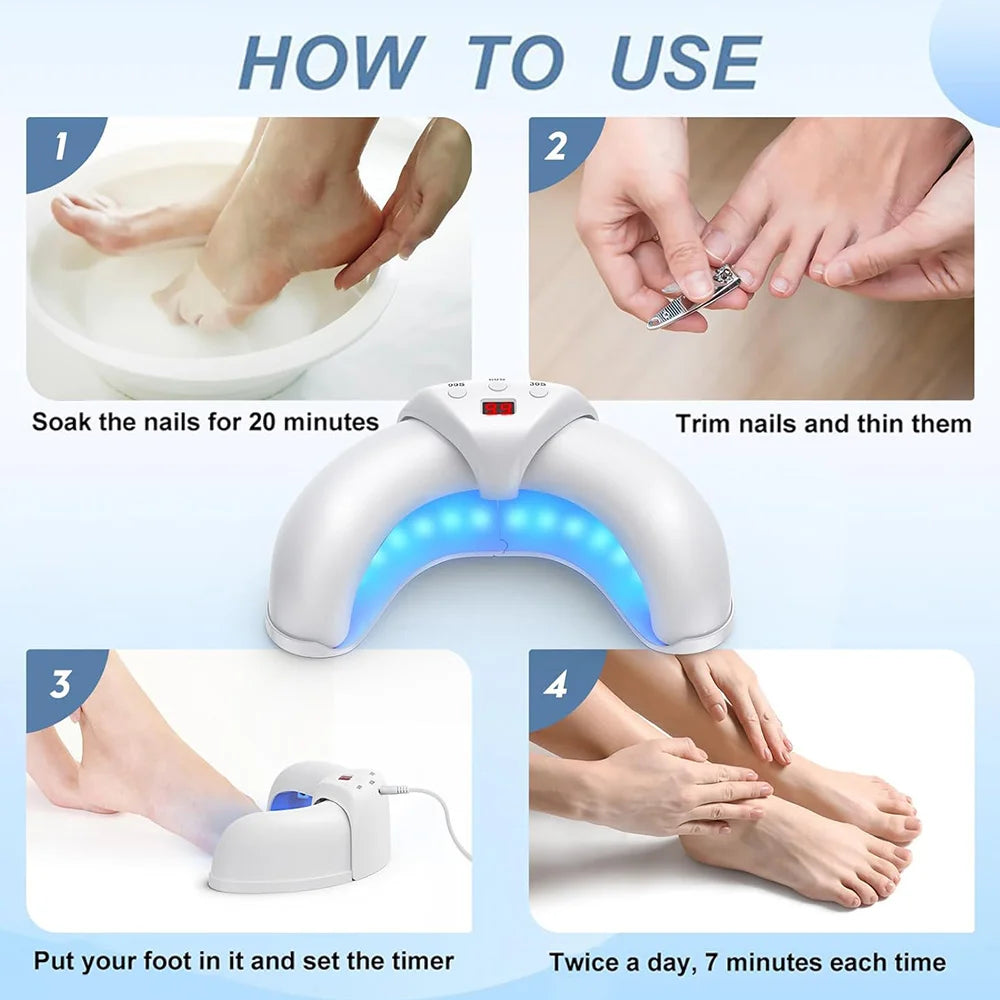 Nail Fungus Laser Device for Multiple Toenail 905nm470nm 7Minutes Painless Removes Ingrown Toenail Calcium Nail Fungus Treatment