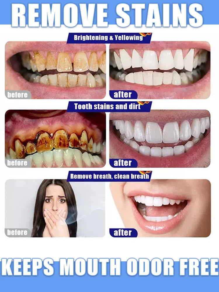 2025 New Formula 7-Day Whitening Essence Gel – Effectively removes coffee, tea, and tobacco stains, protects tooth enamel and p