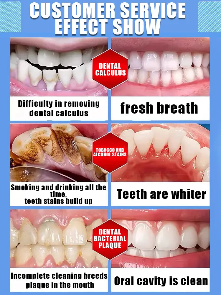 2025 New Formula 7-Day Whitening Essence Gel – Effectively removes coffee, tea, and tobacco stains, protects tooth enamel and p