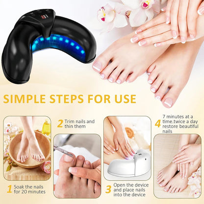 Nail Fungus Laser Device for Multiple Toenail 905nm470nm 7Minutes Painless Removes Ingrown Toenail Calcium Nail Fungus Treatment
